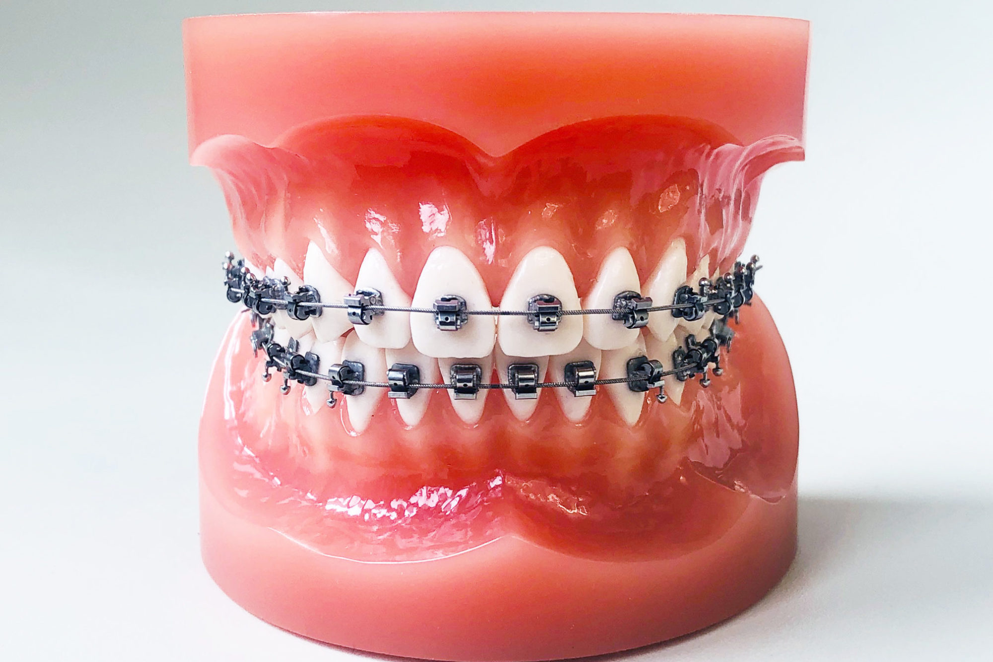 Um Die Zähne Des Tages Zu Korrigieren ,Clear Die Erste Stufe Erwachsene Kieferorthopädische Zweistufige Unsichtbare Zahnspangen Um Die Boxklammern Zu Behalten